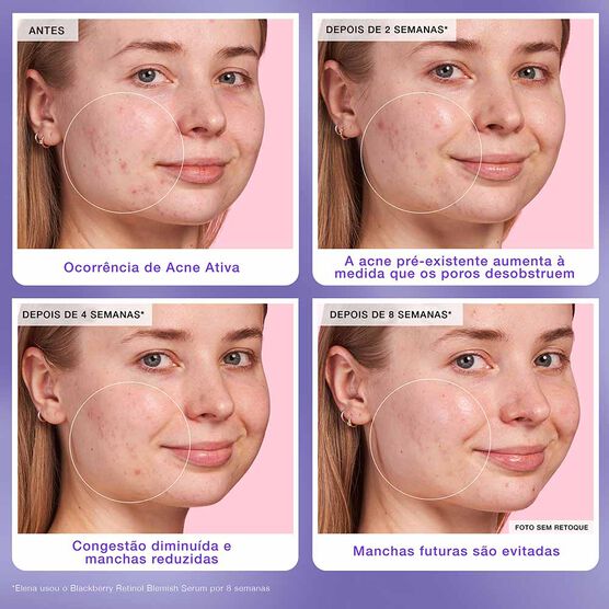 BLACKBERRY BLACKBERRY RETINOL SERUM 30ML