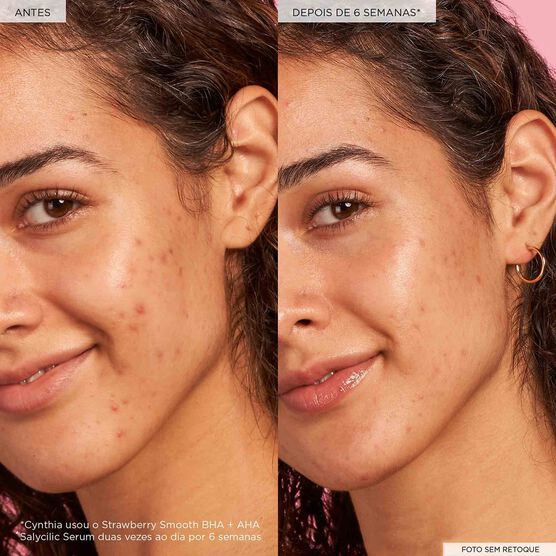 S&Eacute;RUM UNIFORMIZADOR COM &Aacute;CIDO SALICILICO GLOW RECIPE STRAWBERRY BHA+AHA